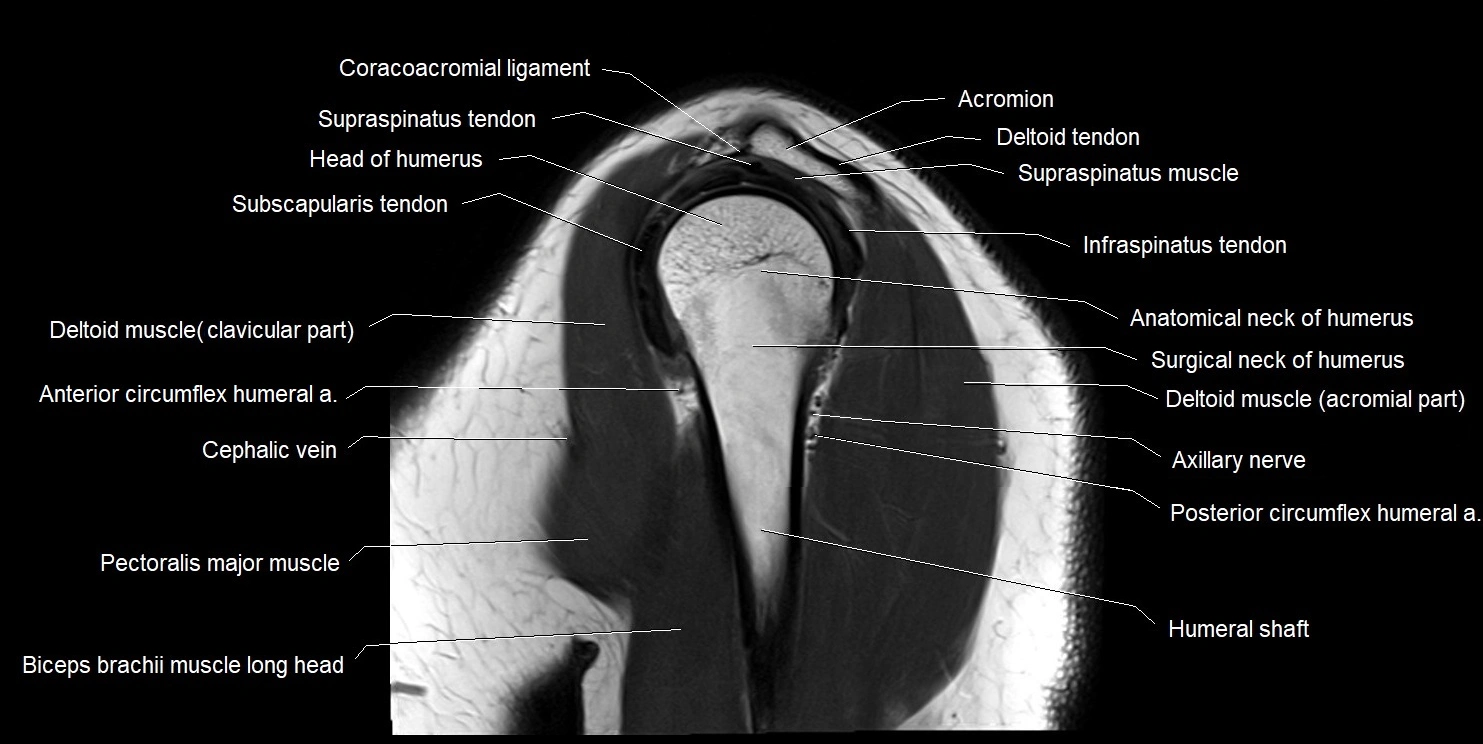 mri shoulder sagittal cross sectional anatomy image 13.webp